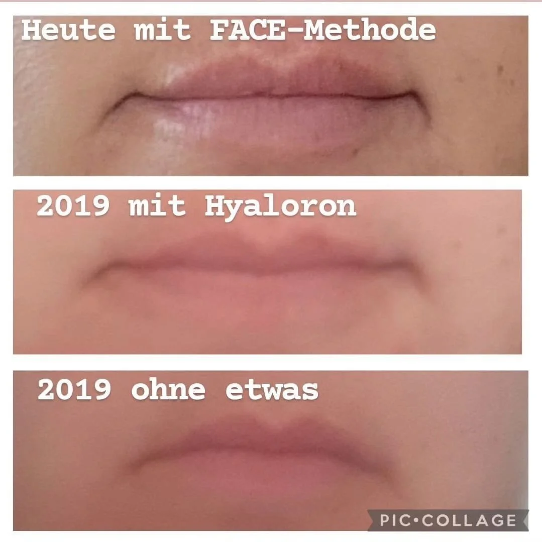Lippen und untere Gesichtshälfte — Ergebnis von gezieltem FACE-Training