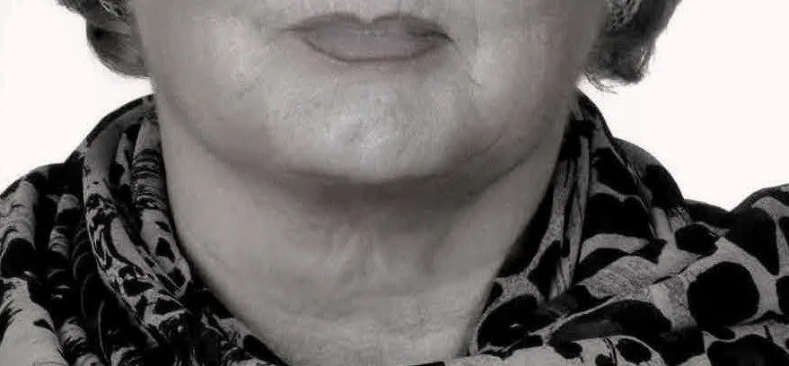 Lippen, untere Gesichtshälfte und Hals nach sechs Monaten FACE-Training