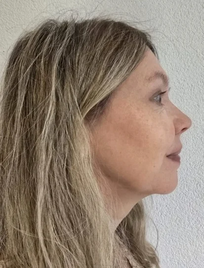 Kundin (56) nach sechs Monaten Training mit der FACE-Methode®, Profilansicht